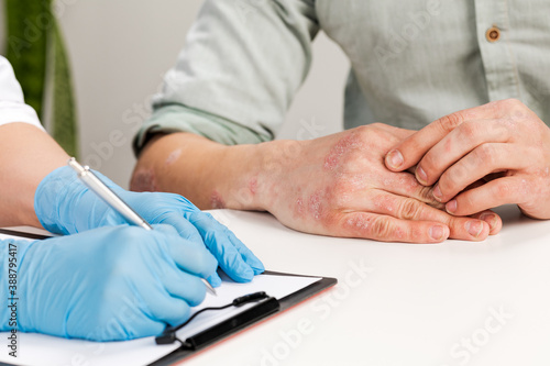 A gloved dermatologist examines the skin of a sick patient and records observations. Examination and diagnosis of skin diseases-allergies, psoriasis, eczema, dermatitis