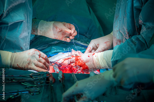  gynecologist sews a uterus back together after a caesarean section