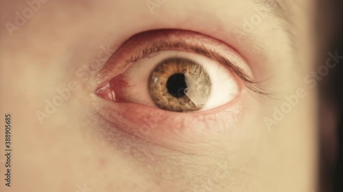 Wide open eye. Constriction of the pupil. Man with green eyes looks ahead with eyes wide open.