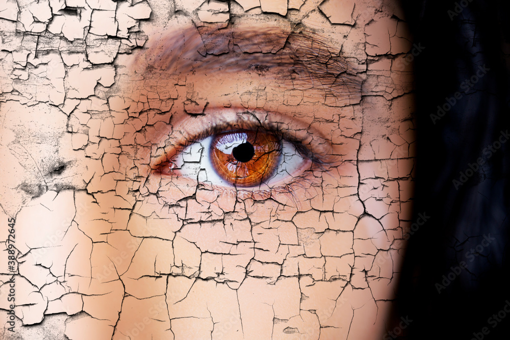 A beautiful insightful look eye with vitiligo. Close up shot