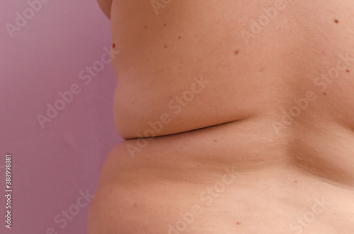 Woman with body, fat, creases