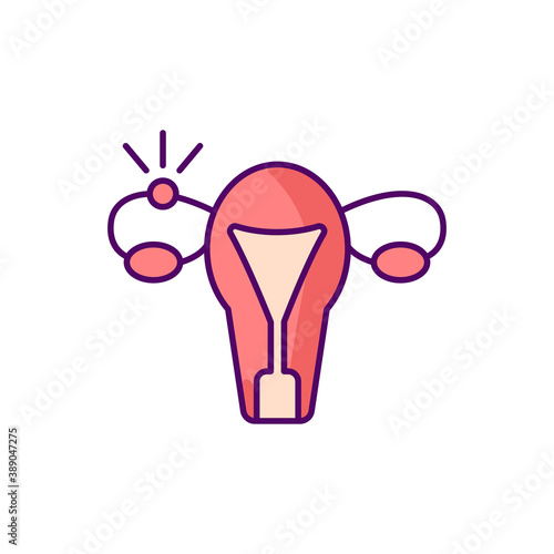 Ectopic pregnancy RGB color icon. Fallopian tube. Embryo outside uterus. Tubal, extrauterine complication. Abdominal pain. Vaginal bleeding. Uterine lining. Isolated vector illustration