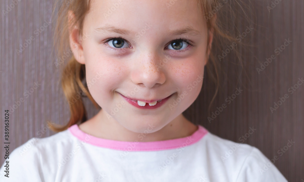 Naklejka premium Kid with projecting upper front teeth