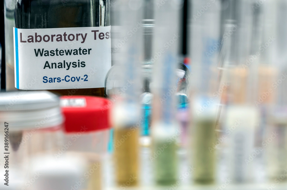 Wastewater samples, analysis of sars-cov-2 virus in patients infected by human coronavirus 229E, conceptual image Wastewater samples, analysis of sars-cov-2 virus in patients infected by human coronavirus 229E, conceptual image