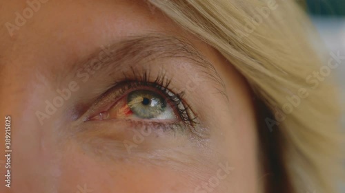 close-up, detailed eye of a woman with a bloody spot. burst capillary in the eye.
