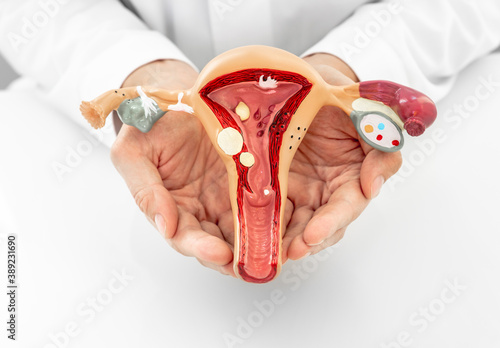 Fotografi Doctor showing an anatomical model of the uterus and ovaries with pathologies, close-up