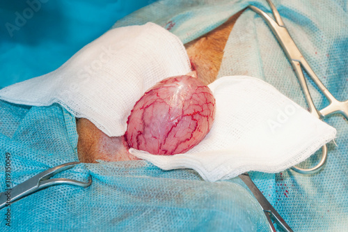 Surgery field. Bladder. Anatomical structure