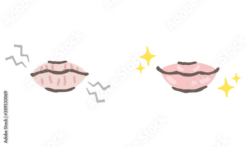 ガサガサの唇とつやつやの唇