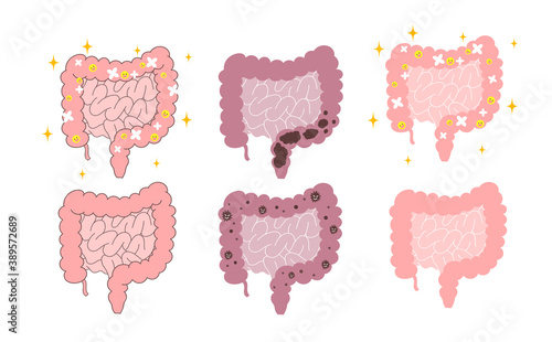 腸のイラスト