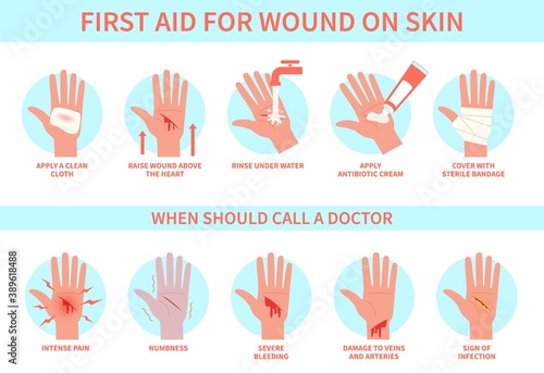 First aid for wound on skin. Damage, bleeding cut hand skin and emergency treatment procedure, therapy injury medical guide, information poster help steps vector flat infographic