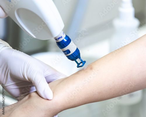 Konstfotografi Scar removal/ hair removal treatment on the skin using CO2 technique