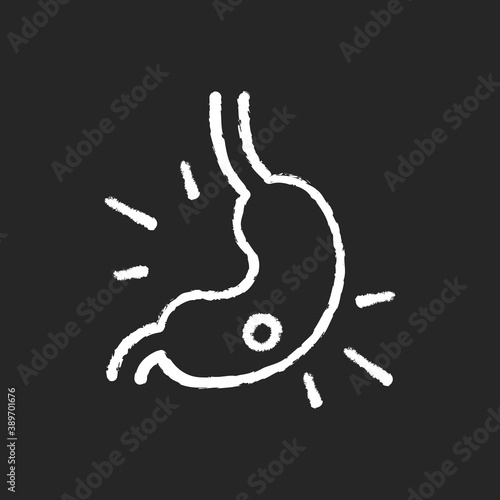 Gastritis chalk white icon on black background. Stomach ulcer. Upper abdominal pain. Gastric mucosa. Gnawing and burning ache. Stomach lining inflammation. Isolated vector chalkboard illustration