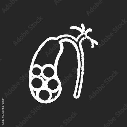 Gallstones chalk white icon on black background. Cholelithiasis. Hardened bile deposits. Solid material in gallbladder. Gall stones. Digestive discomfort. Isolated vector chalkboard illustration