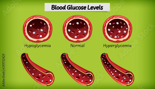Medical blood glucose level