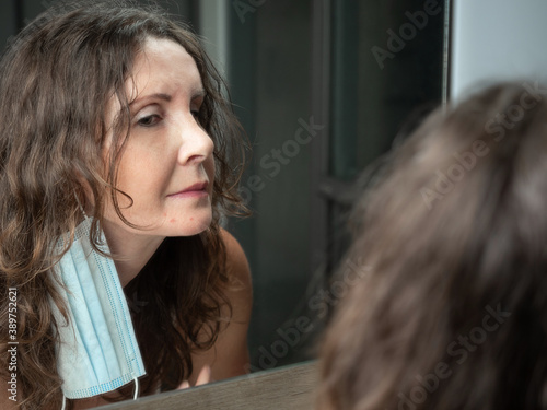 Caucasian middle - aged woman suffering from acne on her chin after wearing protective face mask. photo