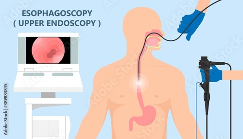 Dysphagia infection trachea examine Surgery choking gastric diagnose windpipe disorder bleeding surgical GERD treat tumor throat biopsy system ulcers stomach block eat food stuck test tract stent pain