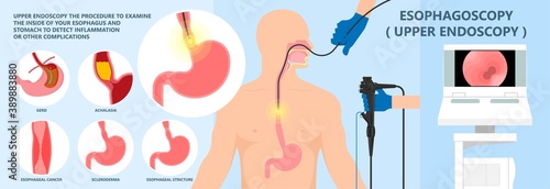 Dysphagia infection trachea examine Surgery choking gastric diagnose windpipe disorder bleeding surgical GERD treat tumor throat biopsy system ulcers stomach block eat food stuck test tract stent pain