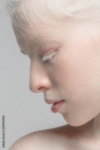 Profile. Close up portrait of beautiful albino female model. Parts of face and body. Beauty, fashion, skincare, cosmetics, wellness concept. Copyspace. Well-kept skin, fresh look, details.