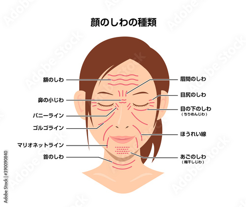 女性の顔のしわ ( 発生場所と名称 ) ベクターイラスト
