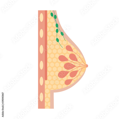 Breast disease concept