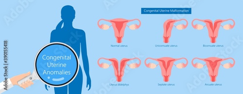 Abnormal uterus Tipped septum missed mature cervix double absent defect system period loss cycle birth labor short uterus female treat Risk type exam woman ducts Shape