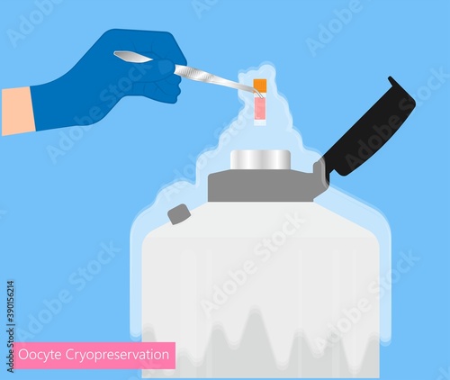 egg freezing embryo fertile helium sample Liquid frozen oocyte social In IVF lab slow test tube baby ICSI bank stem cell women sperm birth vitro gamete treat count