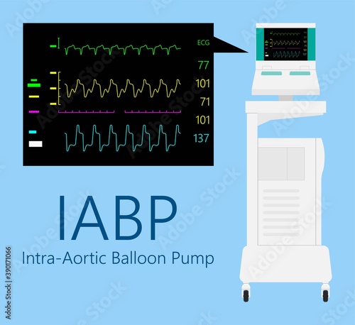 IABP repair lab ICU lung cath left LVAD ECMO care unit artery disease surgeon patient surgery cardiac machine medical heart treat shock attack angina acute defect assist valve stent device bypass photo