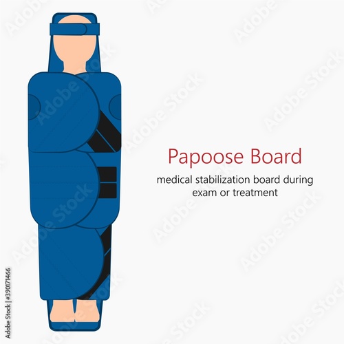 Papoose board medical equipment patient procedure autonomic nervous system