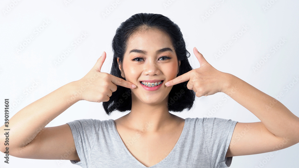 Asian teen facial with braces and smiling to camera to show dental orthodonic teeth which include professional metal wire material from orthodontist. studio shot white background. Asian teen facial with braces and smiling to camera to show dental orthodonic teeth which include professional metal wire material from orthodontist. studio shot white background.