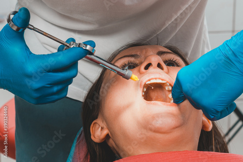 The dentist with the help of a carpule syringe injects anesthesia into the patient s gums  local anesthesia.