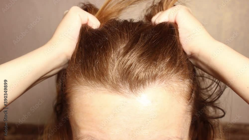 A woman gives herself a massage of the of the head. Improved blood circulation in the head. Close-up of the Upper part of the head. A woman gives herself a massage of the of the head. Improved blood circulation in the head. Close-up of the Upper part of the head.