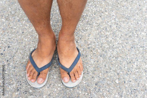 An Asian man's feet are wearing old white flip-flops, blue belt straps. Standing on a concrete road, the concept of poverty during the crisis.