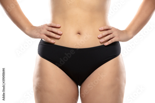Front view. Overweight woman with fat cellulite legs and buttocks  obesity female body in black underwear isolated on white background. Orange peel skin  liposuction  healthcare and beauty treatment.