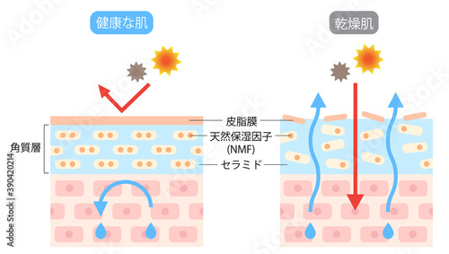 乾燥肌　ビフォアアフター　断面図