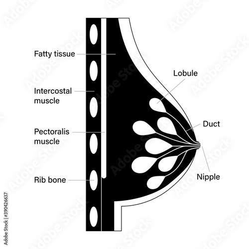 Breast disease concept