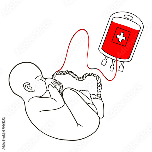 Taking umbilical cord blood, stem cells from an infant. Blood sampling bag. Baby in the womb. vector illustration, eps10. Hand drawn illustration for cards, posters, stickers and professional design.