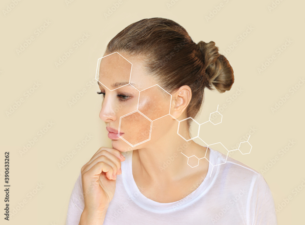 Crème Herbal Aadyalife Contre L'hyperpigmentation Et Le Chloasma - Soin Taches, 30g, Pour Tout Type De Peau