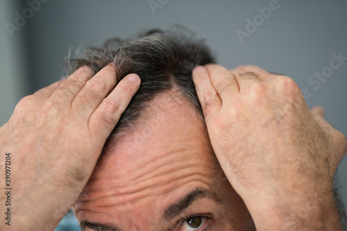 Man Checking His Hair Loss