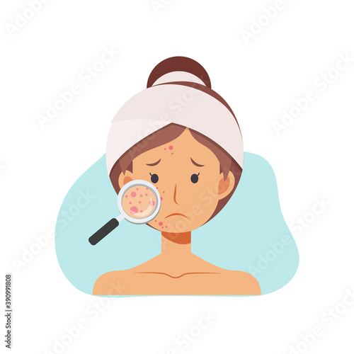 vector illustration about Acne skin problems Concept.  woman with magnifying glass is looking acne on her facial.