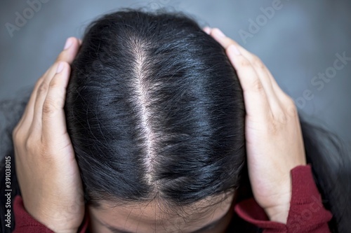 close up woman looks at hair loss.