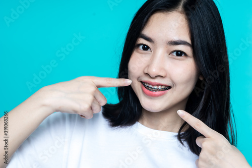 Fototapeta Naklejka Na Ścianę i Meble -  Asian woman wearing dental braces pointing to tooth sample and smiling with her healthy white teeth isolated shot on blue background