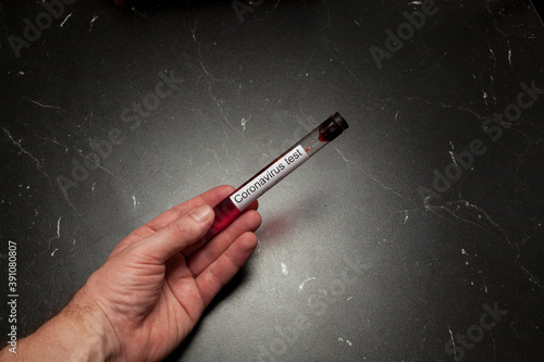 Test tube containing a blood sample, test tube for Covid-19 (coronavirus) analyzing. Laboratory testing patient’s sample