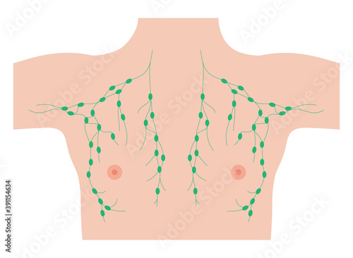 Breast disease concept