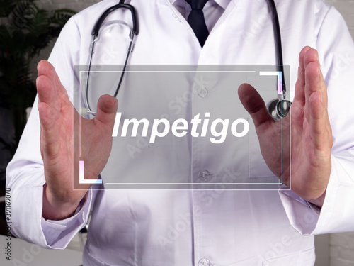 Photography Health care concept meaning Impetigo  with phrase on the piece of paper