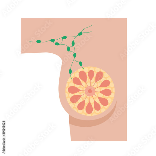 Breast disease concept