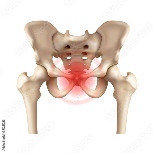 Human pelvic bone with highlighting of the area of ​​pain in the symphysis pubis. Vector illustration