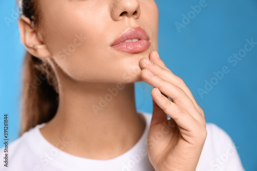 Woman with herpes on lips against light blue background, closeup