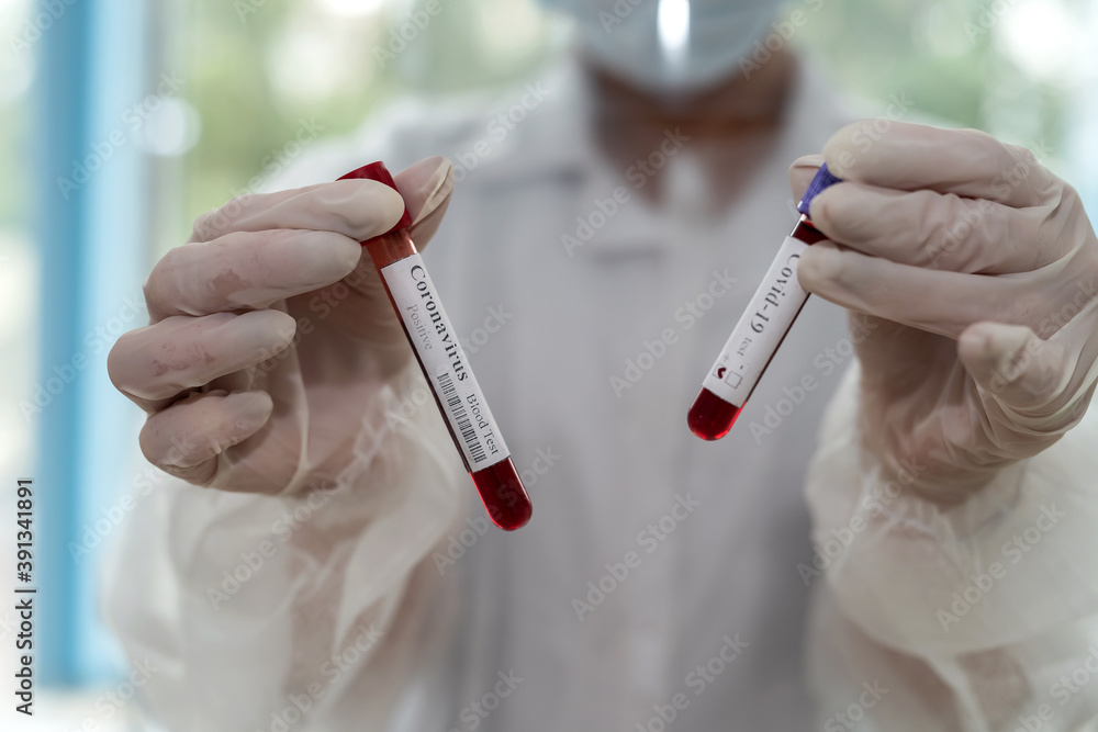 Test tube in female hand with blood sample for testing Coronavirus COVID-19. concept diagnostic Test tube in female hand with blood sample for testing Coronavirus COVID-19. concept diagnostic
