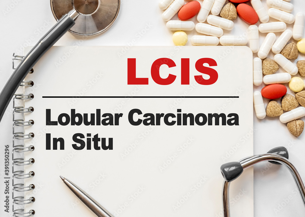 Page in notebook with LCIS Lobular Carcinoma In Situ on white background with stethoscope and