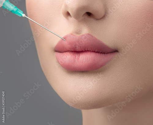 Lip filler injections. Fillers. Lip augmentation Beautiful Perfect Lips with hyaluronic acid. Sexy Mouth close-up. Beauty young woman Lips. Close up over grey background 